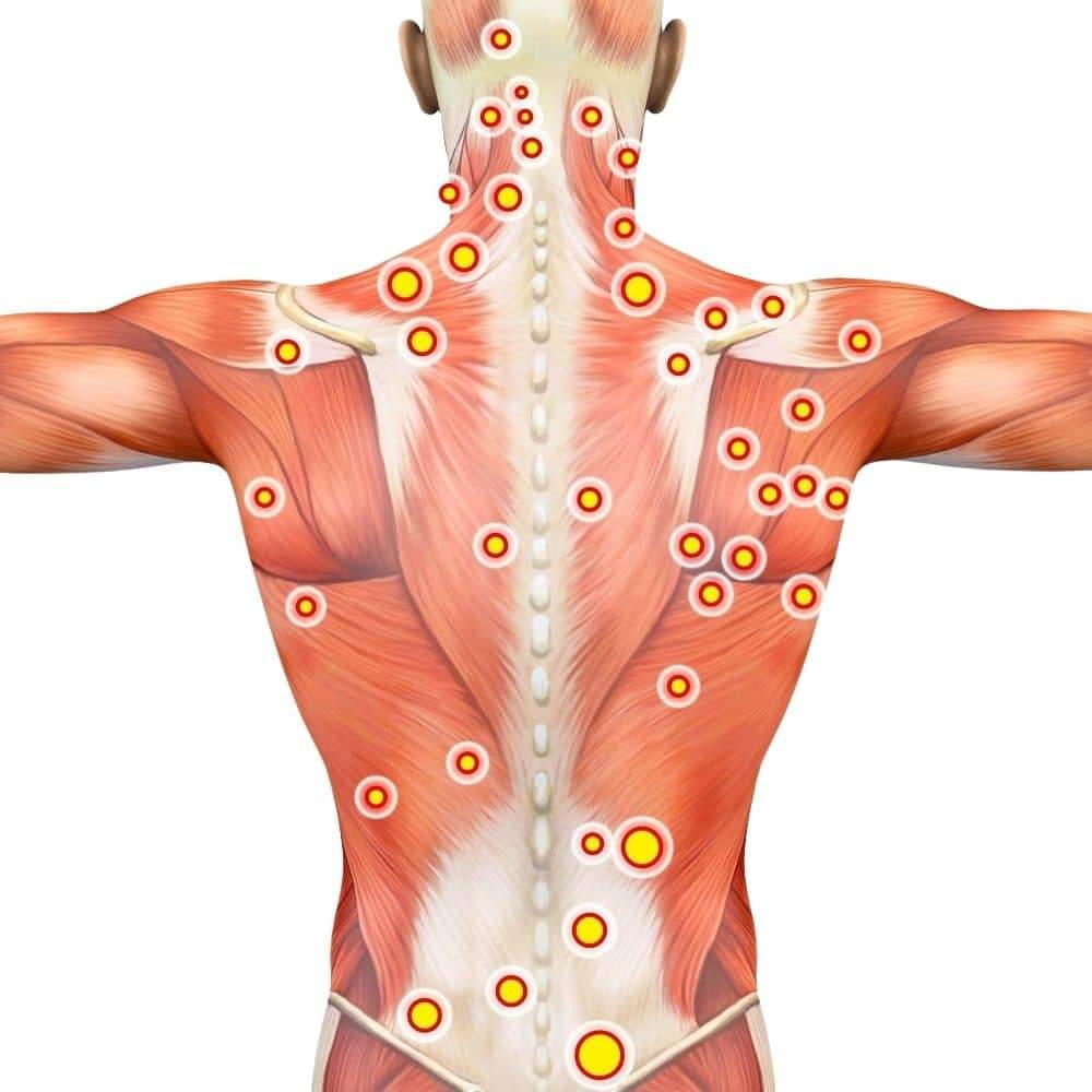 dry needling in lees summit