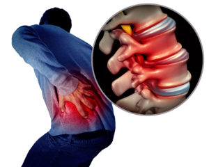 causes of lower back spasms c